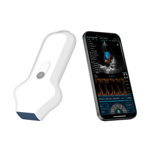 Sonda inalámbrica Phased Array YSB-C10UC para ecocardiogramas en tiempo real.