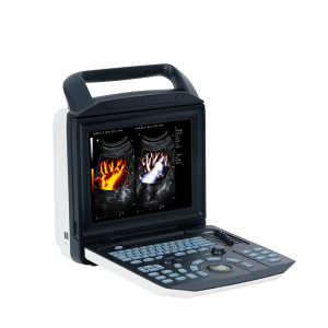 Ecógrafo portátil Doppler Color YSB-M5 con pantalla de 12 pulgadas para clínicas.