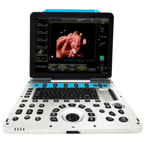 Ecógrafo portátil 4D Doppler Color YSB-P30 con pantalla de 15 pulgadas HD.